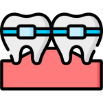 Dental Braces